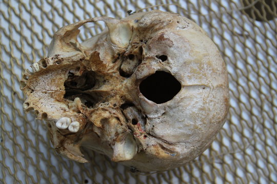 Human skull skeleton part for medicine education