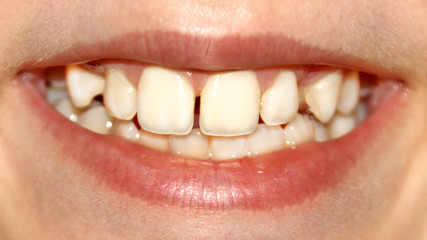 smile teeth beautiful tender white