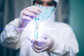 Medical laboratory technologist holding test tube with sampling contaminated with 2019-nCoV or Coronavirus lab test in COVID-19 situation outbreaking , Epidemic Virus Respiratory Syndrome