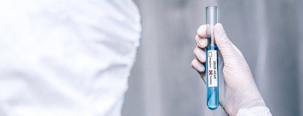 Medical laboratory technologist holding test tube with sampling contaminated with 2019-nCoV or Coronavirus lab test in COVID-19 situation outbreaking - Panoramic Banner