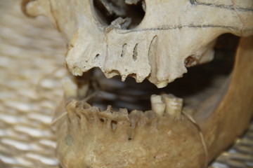 Human skull skeleton part for medicine education