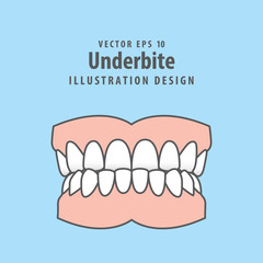 Dental underbite teeth illustration vector design on blue background. Dental care concept.