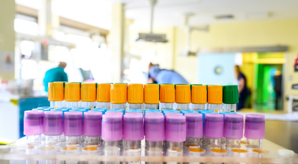 Corona virus blood samples in intensive care unit