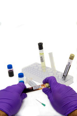 Background medical treatment on white background of ebola test, coronavirus, covid-19