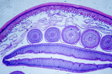 Microscopic image of Ascarid (cross-section)