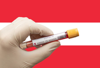 COVID-19 Pandemic Coronavirus concept ; Close-up of a Positive COVID-19 blood test sample tube with Flag of Austria at background. Blood testing for diagnosis new Corona virus infection.