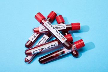 test tubes with blood samples and coronavirus test lettering on blue