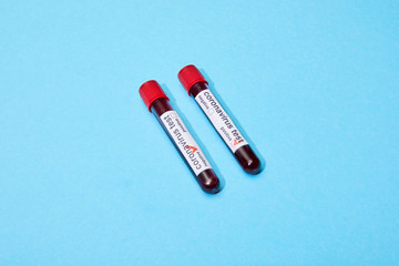 test tubes with blood samples and coronavirus test lettering on blue