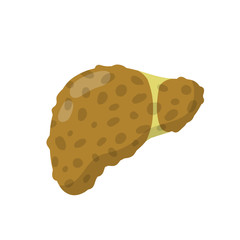 Bad liver. Medical Disease of human internal organ. Health problem - Cirrhosis. Cartoon flat illustration