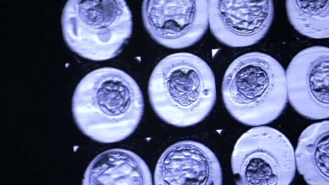 On monitor screen, photographs of stages of development of human embryo, eco, fertilization, cell division, growth, fetal development, modern technology, women's health, new life, under observation