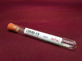 Test sample positive swab for coronavirus COVID-19