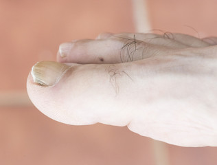 Toes in natural daylight showing fingernails and phalanx hairs