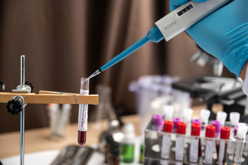 Blood test samples for presence of coronavirus (COVID-19) tube containing a blood sample that has...