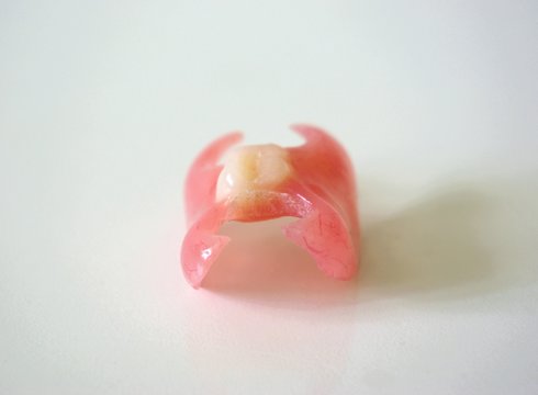 Removable denture type Butterfly on a light background. Replacement of one missing tooth. Closeup.
