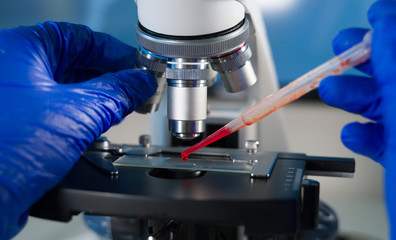 Close-up shot of laboratory microscope with blood sample.