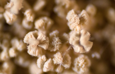 Aspergillus (mold) under microscope view in laboratory.
