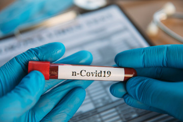 Doctor Holding Pandemic Coronavirus 2019-nCoV Blood Sample Positive Test Tube. Doctor wearing medical mask and gloves and shows patient's blood test tube containing corona virus (COVID-19)