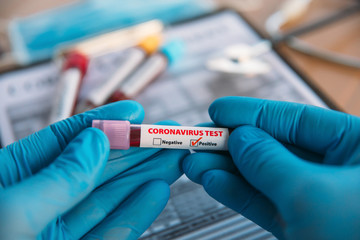 Doctor Holding Pandemic Coronavirus 2019-nCoV Blood Sample Positive Test Tube. Doctor wearing medical mask and gloves and shows patient's blood test tube containing corona virus (COVID-19)