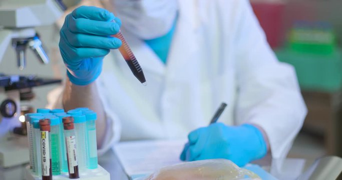A healthcare professional in a small laboratory documents a sample of blood plasma he is holding as part of ongoing test trials for treating patients infected with COVID19.
