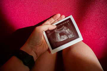 pelvic screening ultrasound, pregnancy 10 11 weeks, photo of the embryo on the lap of a girl on a...