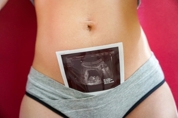 photograph of the embryo, results of perinatal screening in the abdomen of a woman, pregnancy 10 11...