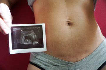 photograph of the embryo, results of perinatal screening, abdomen of a woman, cesarean scar,...