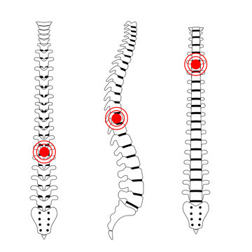 Human spine pain vector illustration