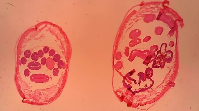 Microscope Ascaris Cross Section x600