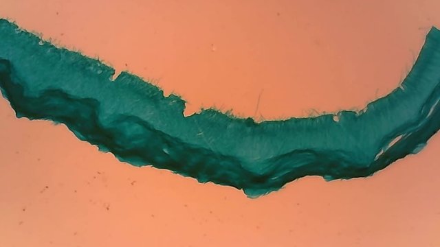 Microscope Aspergillus Whole Mount x800