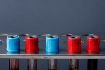 Blood samples in a test tube rack