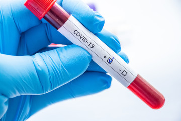 Laboratory technician, medical specialist, doctor or scientist holds blood test tube in his hand, where coVID-19 is written and positive result of analysis for coronavirus is shown to camera close-up