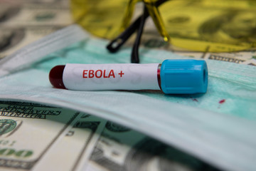 Positive testing at Ebola