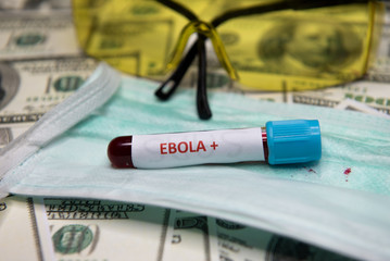 Positive testing at Ebola