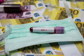 Positive testing at HIV