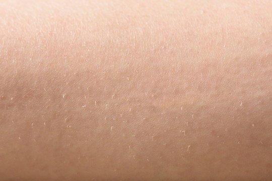 Female skin with hair on legs close-up. The concept of depilation, beauty and skin care.