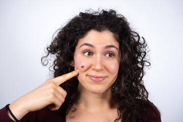 Young pretty caucasian curly haired woman pointing on her face with big mole on cheek. Sun exposure...