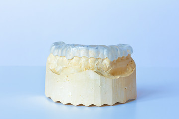 Grind guard made out of clear plastic on a custom-made tooth model, used against excessive wear caused by bruxism