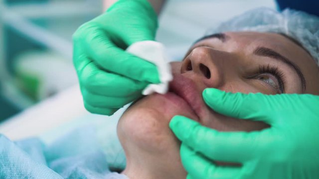 CU: cosmetologist in green rubber gloves massages female client upper lip with cotton disk after augmentation in modern cosmetology clinic closeup