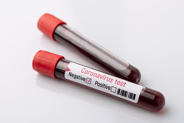 Negative test on Covid-19 virus on white table