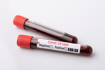 New case of Covid-19. Test-tube with blood sample on white table