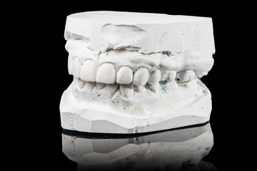 medicine, tooth, dentistry, impression, prosthesis, dentist, dental, cast, implant, denture,...