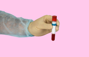 Hand holding blood sample in vacuum tube. Positive test result for the new rapidly spreading Coronavirus