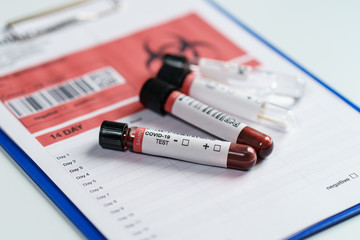 Blood test samples tube, reagent testing tube and swab collection kit in the laboratory, Coronavirus testing process. (Fake QR code and barcode)