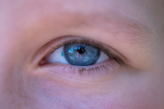 blauer Fremdk&ouml;rper im menschlichen Auge