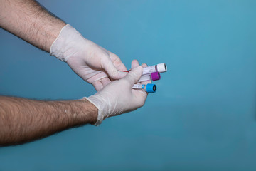 hands with the protection worms on a blue background, holding some test tubes to analyze the COVID-19, or with a mask. OK

