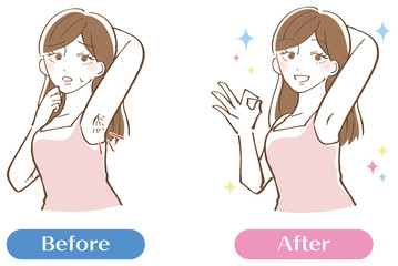 ワキ　ムダ毛　脱毛　セット