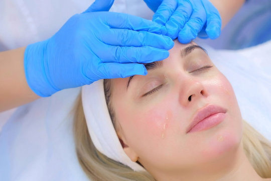 Cosmetologist Is Applying Moisturizing Oil On Young Woman's Face, Closeup Portrait, Top View. Beautician Doctor Is Putting Oil On Girl's Skin Massaging Face. Skincare Procedure In Cosmetology Clinic.