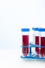 Blood Testing Samples in Laboratory. Covid-19 Blood Test Concept