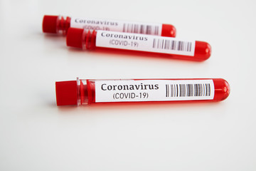 Coronavirus Blood Test in Laboratory