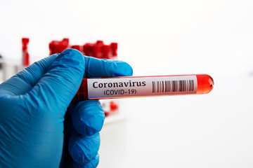 Coronavirus Blood Test in Laboratory